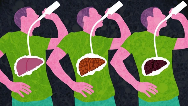 Gráfico: hombre bebiendo