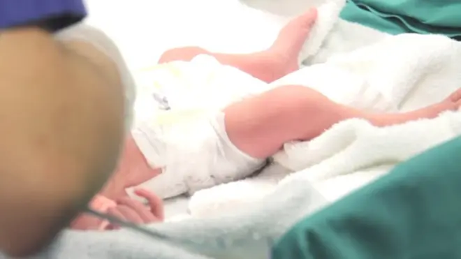 One of the twins filmed immediately after being born
