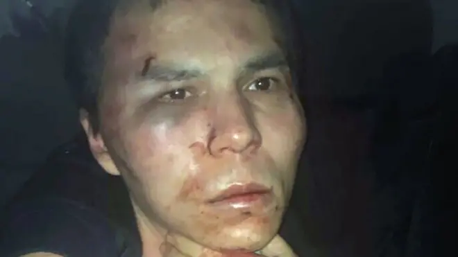 الشرطة التركية نشرت صورة المشتبه به ووجه به كدمات