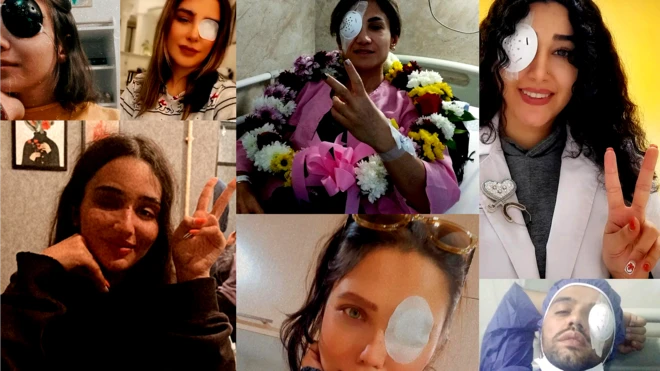 این گزارش گزیدهای از تصاویر و نوشتههای زخمیانی است که از تجربه، احساس، خشم و امید، پس از زخمی شدن چشمشان نوشتهاند