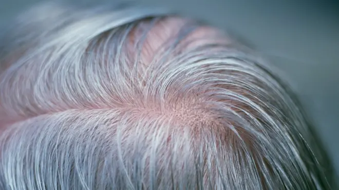 دراسة طبية مصرية تشير إلى احتمال ارتباط درجة الشيب بخطر أمراض القلب والشرايين