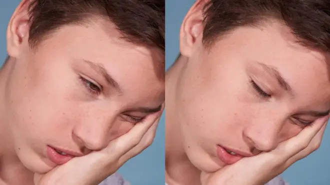 Hələ də narkolepsiyanın real müalicəsi aşkarlanmayıb