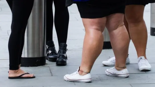 Milenyum kuşağı ve obezite