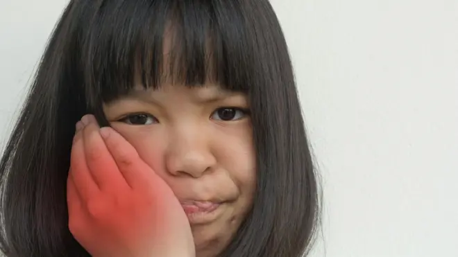 Seorang anak perempuan menaruh tangan di pipinya menahan sakit gondongan.