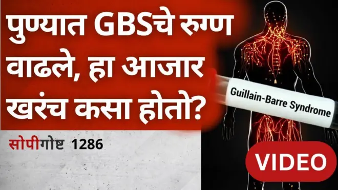 GBS