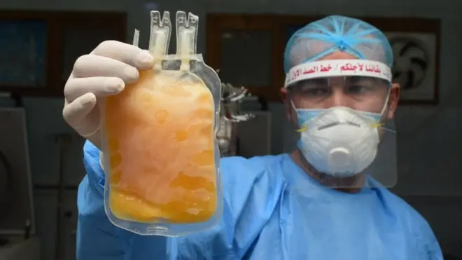 प्लाज़्मा