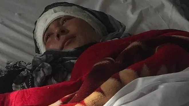 Zarina se encuentra en recuperación en un hospital del norte de Afganistán, pero su esposo se encuentra aún prófugo.