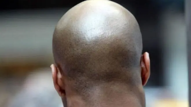 Лисий чоловік