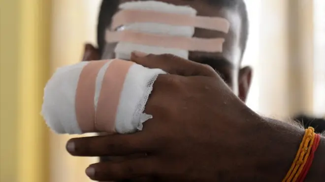 Wound treatment fit improve according to research people