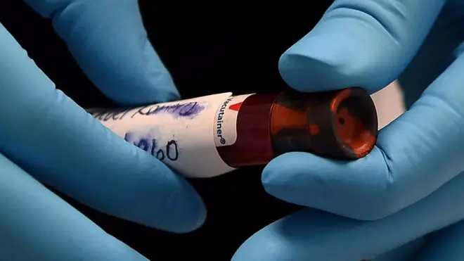 اختبار جديد للأجسام المضادة