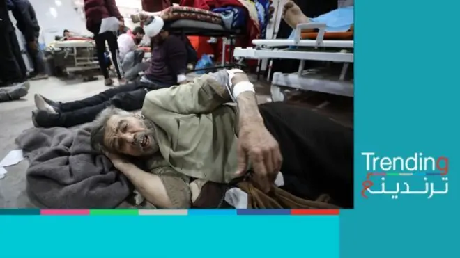 صور لفلسطيني أصيب أثناء محاولته الحصول على مساعدات إنسانية