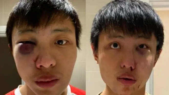 "عنصرية" ضد آسيويين بسبب "فيروس كورونا"