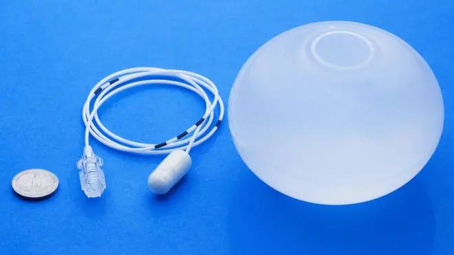 Este globo gástrico temporal puede ayudar a los pacientes obesos a perder kilos sin tener que someterse a endoscopias.