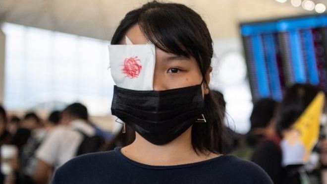 Una mujer con un parche en el ojo protestante en el aeropuerto de Hong Kong.