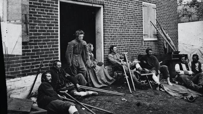 Muitos soldados que lutaram na Guerra Civil enfrentaram amputações e sequelas permanentes. A imagem mostra quatro feridos fotografados entre 1861 e 1865