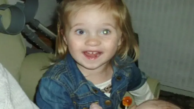 रेटिनोब्लास्टोमा