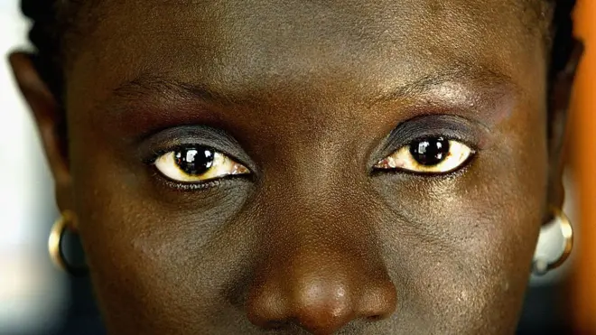 رغم أن إفريقيا تشهد أكبر انتشار للختان، تنتشر هذه الممارسة في بعض دول آسيا وأمريكا اللاتينية