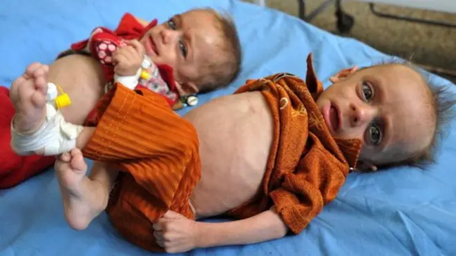 خوارځواکي ماشومان