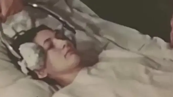 کیمرون معمول کے برعکس 30 سے 40 گنا زیادہ پاور کے ساتھ الیکٹرک شاک تھراپی کرتے تھے