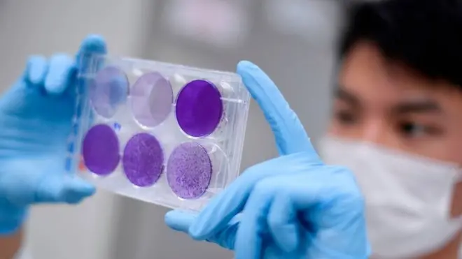 دنیا بھر میں کم از کم 44 مختلف پروجیکٹس کوویڈ 19 کی ویکسین کی تلاش میں ہیں