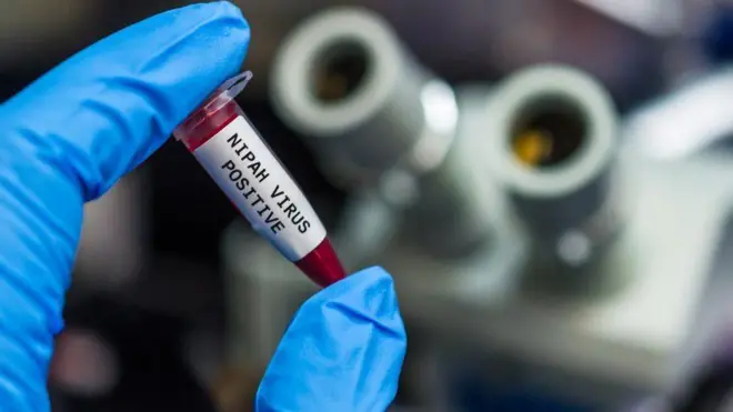 ਨਿਪਾਹ ਵਾਇਰਸ 