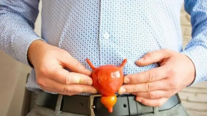 ప్రోస్టేట్ క్యాన్సర్