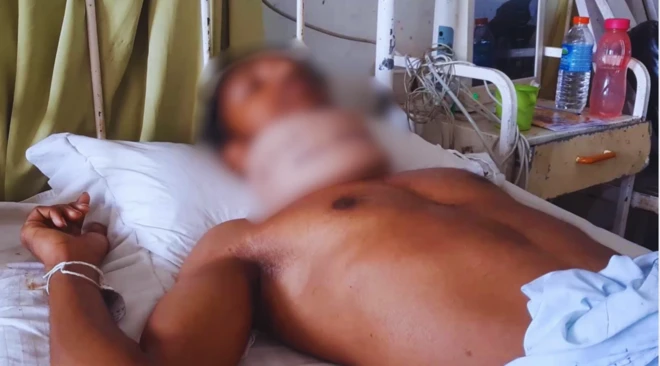 දැනට අනුරාධපුරය ශික්ෂණ රෝහලට ඇතුළත් කර ඇති එම තරුණයා පවසන්නේ පොලිසියෙන් සිදුකළ පහරදීමෙන් සිය වෘෂණ කෝෂයකට සිදුවූ හානිය හේතුවෙන් එය ශල්යකර්මයකින් ඉවත් කිරීමට වෛද්යවරුන් කටයුතු කළ බවයි.