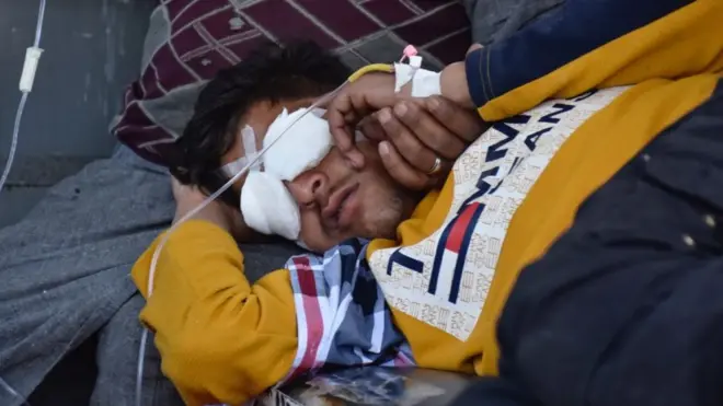 ہسپتال کے ذرائع نے تصدیق کی ہے کہ پچاس افراد فورسز کی کارروائی میں زخمی ہوئے ہیں جن میں سے دس سے زیادہ کی آنکھوں میں چھرے لگے ہیں