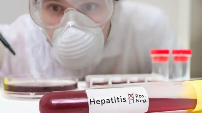 ምርመራ ሕማም ወይቦ ኣብ ቤተ ፈተነ