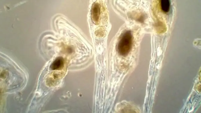 డెల్లాయిడ్ రాటిఫర్