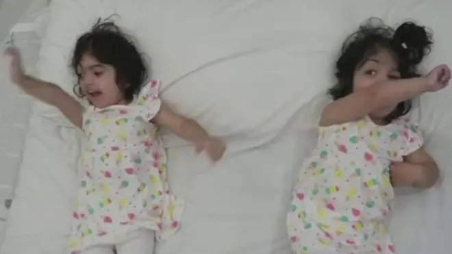 పాకిస్తాన్ కవలలు