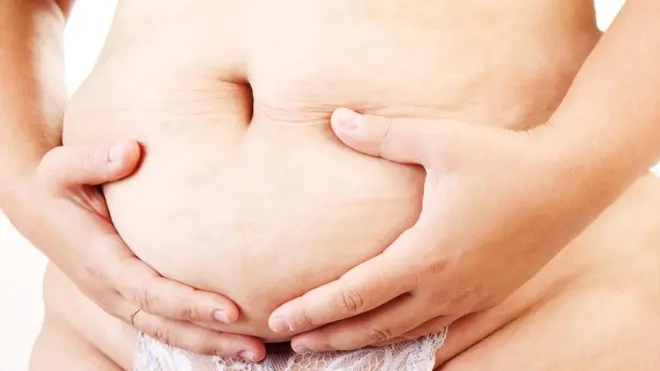 Tras las gestación y el parto los músculos abdominales se pueden quedar estirados, debilitados y separados por un hueco de hasta 5cm.