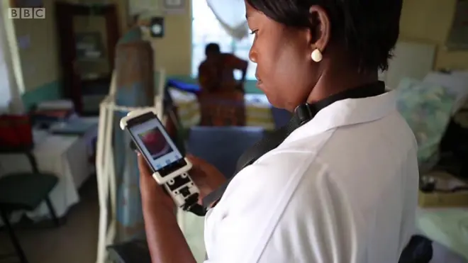 Meeshaa haaraa kaansarii baruuf tajaajilu