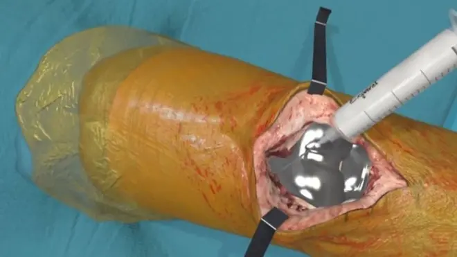 عملية جراحية عبر الواقع الافتراضي