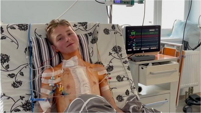 пересадка серця дитині