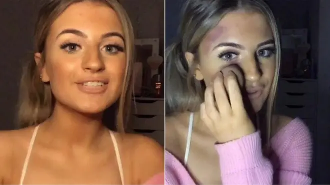 앰버는 가정에서 벌어지는 폭력의 징후들을 무시하고 넘어가지 말라는 메시지를 전달하고 싶었다고 전했다