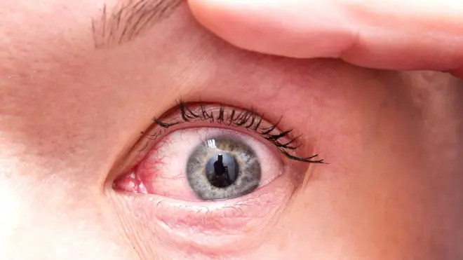 Усталый глаз