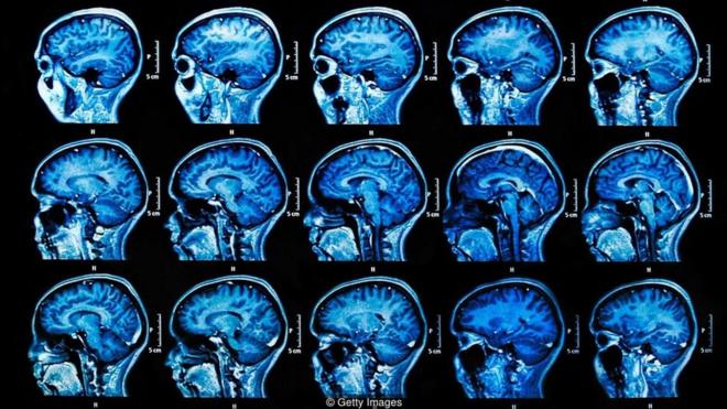 Radiografias do cérebro