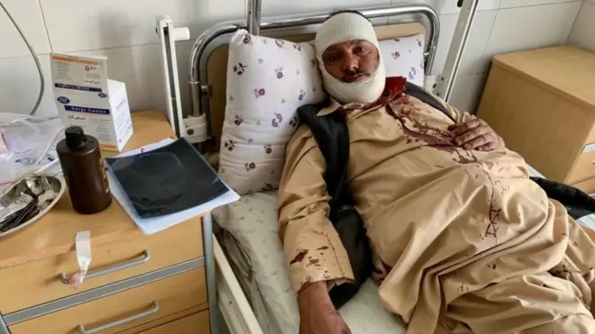More than 30 people were injured at the election rally