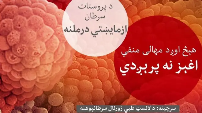 بریتانیا کې جراحي ډاکترانو د پراسټېټ سرطان د لومړيو مرحلو لپاره یوه نوې درملنه موندلې ده چې ډېره ګټوره یې بولي