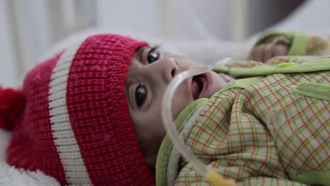 Yemen'de hastanedeki çocuk