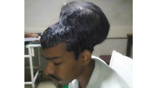 سنت لال کی بیوی نے اخبار دی ہندو کو بتایا کہ انھیں تین مختلف ہسپتالوں میں ڈاکٹروں نے کہا تھا کہ اس رسولی کا آپریشن نہیں ہو سکتا۔