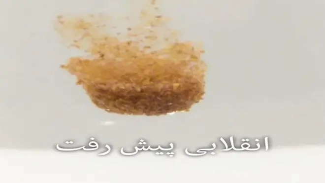 ٹی بی کی نئی دوا