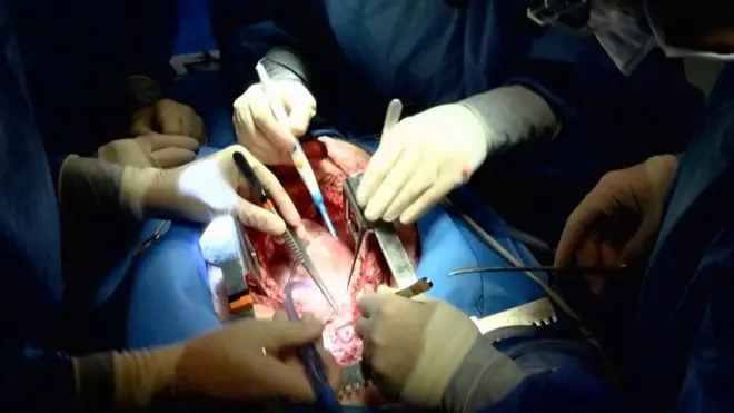 زرع قلب خنزير لأول مرة في إنسان