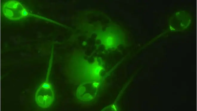 El parásito de aloja en el salmón y forma una especie de quistes.