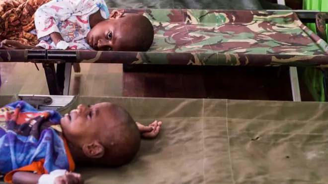 Anak-anak kekurangan gizi di Asmat juga dilarikan ke posko kesehatan yang dibuka TNI di Agats.