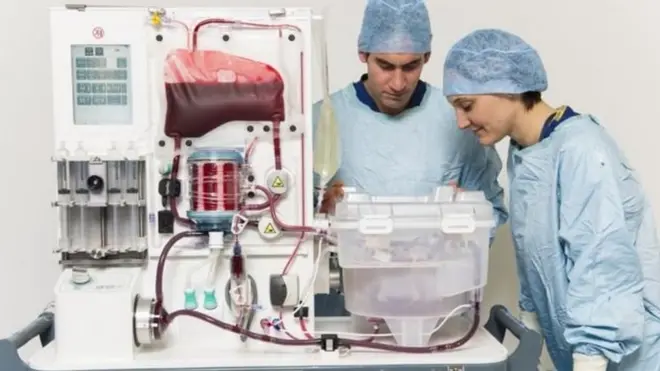 تضخ الآلة الدم إلى الكبد وتمده بالتغذية والأدوية خارج الجسد