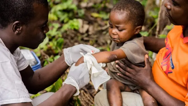 Virus cacar monyet selama ini disebut menjangkiti warga Afrika bagian tengah dan barat.