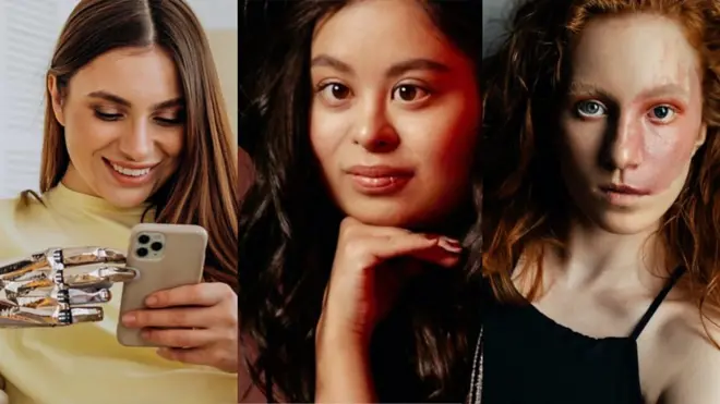 残疾模特:不应害怕展示自己