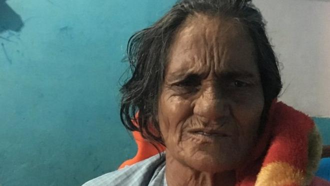 Sundar Devi, 60, has been bedridden since she was attacked on Saturday